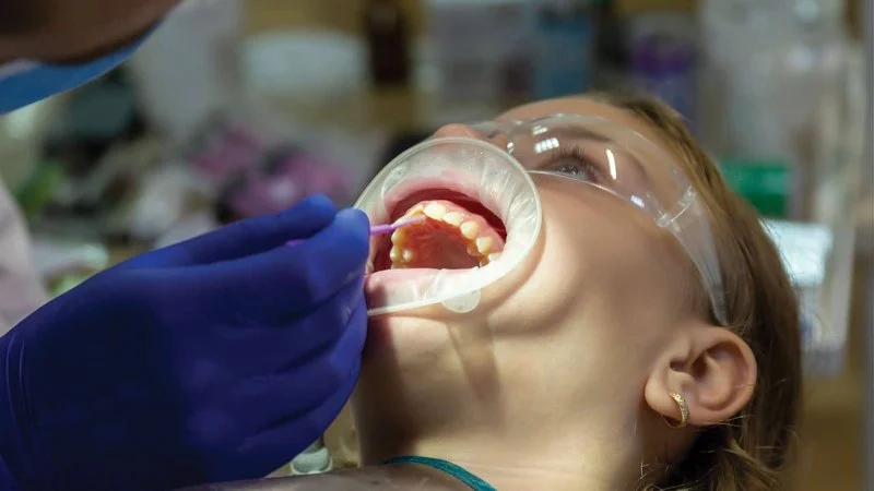 The Role of Fluoride for Dental Health in Contact Sport Athletes